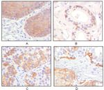 Cytokeratin 5 Antibody in Immunohistochemistry (Paraffin) (IHC (P))