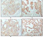 Cytokeratin 8 Antibody in Immunohistochemistry (Paraffin) (IHC (P))