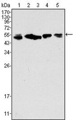 Cytokeratin 8 Antibody in Western Blot (WB)