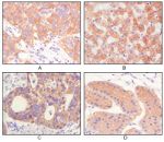 Cytokeratin Pan Antibody in Immunohistochemistry (Paraffin) (IHC (P))