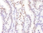 DACH1 Antibody in Immunohistochemistry (IHC)