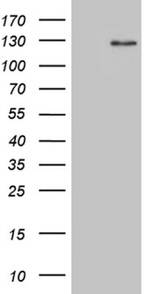 DACT1 Antibody in Western Blot (WB)