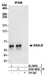 DAGLB Antibody in Western Blot (WB)