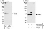 DAP5 Antibody in Western Blot (WB)