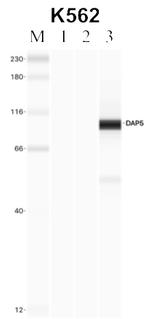 DAP5 Antibody in Immunoprecipitation (IP)