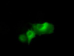 DAPK2 Antibody in Immunocytochemistry (ICC/IF)