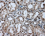 DAPK2 Antibody in Immunohistochemistry (Paraffin) (IHC (P))