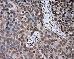 DAPK2 Antibody in Immunohistochemistry (Paraffin) (IHC (P))