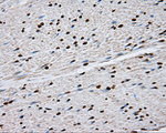 DAPK2 Antibody in Immunohistochemistry (Paraffin) (IHC (P))