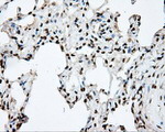 DAPK2 Antibody in Immunohistochemistry (Paraffin) (IHC (P))