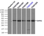 DAPK2 Antibody in Immunoprecipitation (IP)