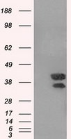 DAPK2 Antibody in Western Blot (WB)