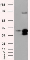 DAPK2 Antibody in Western Blot (WB)