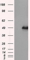 DAPK2 Antibody in Western Blot (WB)