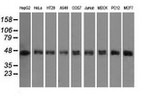 DAPK2 Antibody in Western Blot (WB)