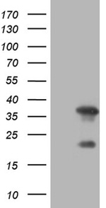 DAPP1 Antibody in Western Blot (WB)