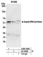 Aspartyl-tRNA Synthetase/DARS Antibody in Western Blot (WB)