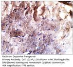 Dopamine Transporter Antibody in Immunohistochemistry (IHC)