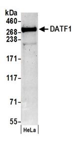 DATF1 Antibody in Western Blot (WB)