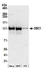 DBC1/p30 DBC Antibody in Western Blot (WB)