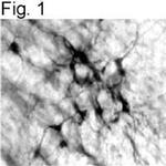 Dopamine beta Hydroxylase Antibody in Immunohistochemistry (IHC)