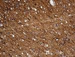 DBN1 Antibody in Immunohistochemistry (Paraffin) (IHC (P))