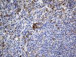 DBN1 Antibody in Immunohistochemistry (Paraffin) (IHC (P))