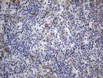 DBN1 Antibody in Immunohistochemistry (Paraffin) (IHC (P))