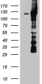 DBN1 Antibody in Western Blot (WB)