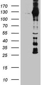 DBN1 Antibody in Western Blot (WB)