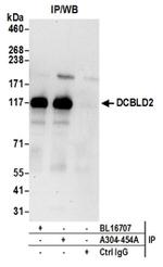 DCBLD2 Antibody in Western Blot (WB)