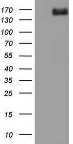 DCC Antibody in Western Blot (WB)