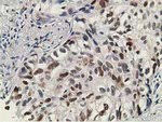 DCK Antibody in Immunohistochemistry (Paraffin) (IHC (P))