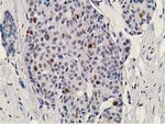 DCK Antibody in Immunohistochemistry (Paraffin) (IHC (P))