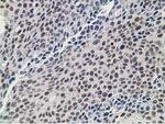 DCK Antibody in Immunohistochemistry (Paraffin) (IHC (P))