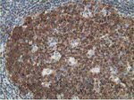 DCK Antibody in Immunohistochemistry (Paraffin) (IHC (P))