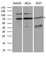 DCP1B Antibody in Western Blot (WB)