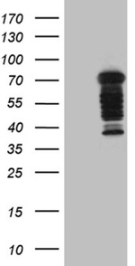 DCP1B Antibody in Western Blot (WB)