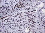 DCPS Antibody in Immunohistochemistry (Paraffin) (IHC (P))