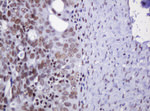 DCPS Antibody in Immunohistochemistry (Paraffin) (IHC (P))