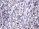 DCPS Antibody in Immunohistochemistry (Paraffin) (IHC (P))