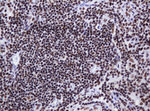 DCPS Antibody in Immunohistochemistry (Paraffin) (IHC (P))