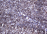 DCPS Antibody in Immunohistochemistry (Paraffin) (IHC (P))