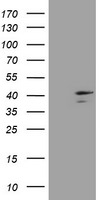 DCPS Antibody in Western Blot (WB)