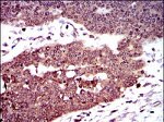 Dynactin 4 Antibody in Immunohistochemistry (Paraffin) (IHC (P))