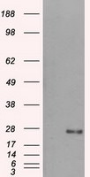 DCXR Antibody in Western Blot (WB)