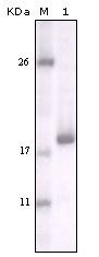 DDR2 Antibody in Western Blot (WB)