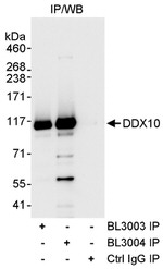 DDX10 Antibody in Immunoprecipitation (IP)
