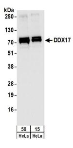 DDX17 Antibody in Western Blot (WB)