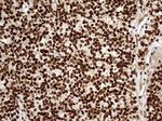 DDX19A Antibody in Immunohistochemistry (Paraffin) (IHC (P))